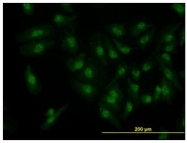 AM31156PU-N - CDK6