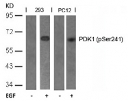 AP02307PU-S - PDPK1