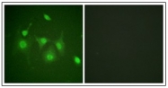 AP31170PU-N - HDAC6