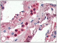 AP22512PU-N - Lactotransferrin