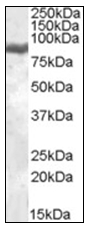 AP22512PU-N - Lactotransferrin