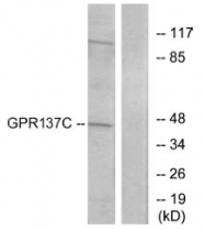 AP31372PU-N - GPR137C