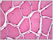 AP31177PU-N - Myoglobin
