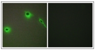 AP31363PU-N - Collagen type XVIII alpha 1 chain
