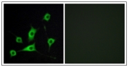 AP31358PU-N - Retinol-binding protein 5 / RBP5