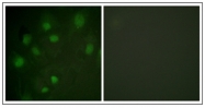 AP31326PU-N - CD222 / IGF2R
