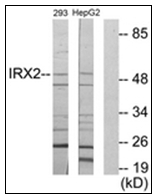 AP31340PU-N - IRX2 / IRXA2