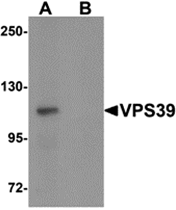 AP26102CP-N - VPS39