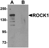 AP26128CP-N - ROCK1