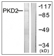 AP31327PU-N - PRKD2 / PKD2