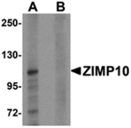 AP26131CP-N - ZMIZ1 / RAI17