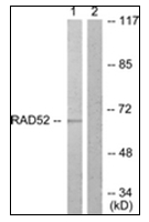 AP31330PU-N - DPYSL2 / CRMP2