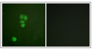 AP31332PU-N - SOX9