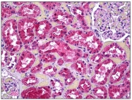 AP31334PU-N - Vinculin (VCL)