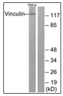 AP31334PU-N - Vinculin (VCL)