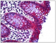 AP31335PU-N - RhoH