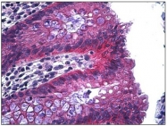 AP31188PU-N - Junction plakoglobin