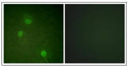 AP31338PU-N - Aurora kinase B