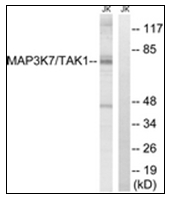 AP31342PU-N - TAK1 / MAP3K7