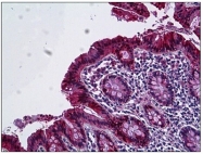 AP31344PU-N - Galectin-3