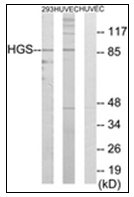 AP31347PU-N - HGS / HRS