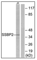 AP31349PU-N - SSBP2