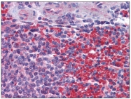 AP31234PU-N - NLRC5