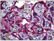 AP31209PU-N - CD120b / TNFR2