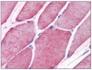 AP31213PU-N - Tectonic-2