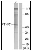 AP31230PU-N - PTH Receptor 1