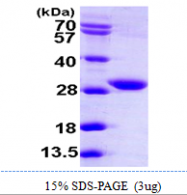AR09888PU-L - KDS reductase