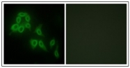 AP31261PU-N - Collagen type V alpha 2 chain