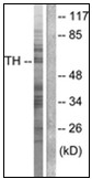 AP31262PU-N - Tyrosine 3-monooxygenase (TH)
