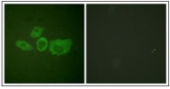 AP31262PU-N - Tyrosine 3-monooxygenase (TH)