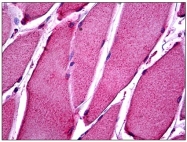 AP31266PU-N - ATP11B