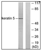 AP31271PU-N - Cytokeratin 5