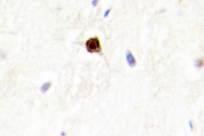 AP06748PU-N - EZH1