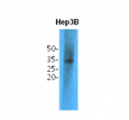 AM09399PU-N - Thiopurine methyltransferase (TPMT)