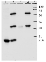 AM26114PU-N - HPV11 E7 Protein