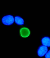 AM26114PU-N - HPV11 E7 Protein