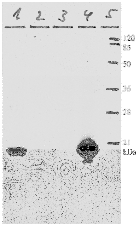 AM26115PU-N - HPV11 E7 Protein