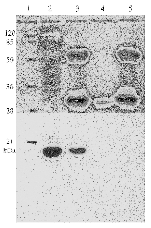 AM26115PU-N - HPV11 E7 Protein