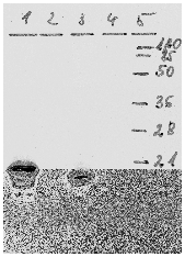 AM26116PU-N - HPV18 E7 Protein