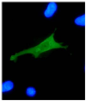 AM26116PU-N - HPV18 E7 Protein