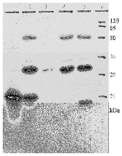 AM26116PU-N - HPV18 E7 Protein
