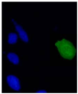 AM26117PU-N - HPV18 E7 Protein