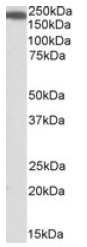 AP23708PU-N - IQGAP1