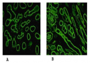 AM26110PU-N - Laminin alpha 5