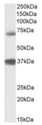 AP23714PU-N - TRIM29 / ATDC