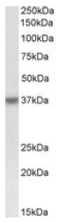 AP23731PU-N - HSH2D / ALX